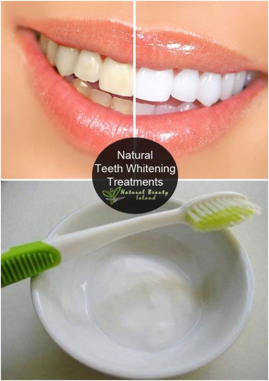 Natural Teeth Whitening 