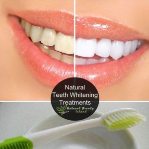 Natural Teeth Whitening from the PND Pinterest Page Image